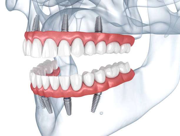 Oral Surgery